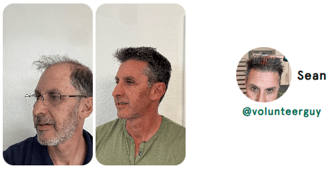 hair loss hair loss reversal natural hair loss reversal receding hair line hair growth natural hair growth hair growth remedy hair loss treatment nutrafol for women hair growth serum nutrafol for men alopecia areata alopecia hair regrowth for men rogaine for women rogaine for men best hair loss treatment hair growth shampoo keeps hair loss hims hair shampoo for hair loss beard growth dht blocker hair loss in women hair regrowth hair loss treatment for men hair doctor near me hair restoration near me hair regrowth for women best hair growth serum beard roller best shampoo for hair loss viviscal pro hair loss treatment for women hair specialist near me hair fall treatment hims hair growth best hair regrowth for men hair growth treatment thinning hair women best shampoo for hair growth vegamour hair serum hims hair loss nutrafol hair growth trichologist near me viviscal hair growth allurium hair growth serum thinning hair vegamour gro hair serum keranique hair regrowth treatment best hair loss treatment for female receding hairline postpartum hair loss hair growth for men hair clinic near me nutrafol hair hair implants for women bondi boost shampoo roman hair loss best hair regrowth for women hair regrowth treatment hair thinning treatment best hair loss treatment for male hair treatment for hair loss regrow hair naturally in 3 weeks best shampoo for hair loss female hair growth for women trichologist hair growth serum for women for hims hair capillus laser cap receding hairline treatment keeps hair treatment dermatologist recommended shampoo for hair loss hair loss prevention hair specialist doctor near me nutrafol women's balance hair transplant for women hair specialist nourishvita hair best shampoo for hair fall bondi boost hair growth female hair loss treatment mens hair loss hair falling out dermatologist hair loss specialist near me hair loss specialist near me best hair loss treatment for men hairfall solution hairmax laserband best hair serum for hair growth thinning hair men hair replacement for women moerie hair growth female hair loss hair fall control telogen effluvium best hair loss treatment for women hair loss doctor near me best hair growth male pattern baldness hair loss shampoo for men best hair regrowth treatment keeps hair loss treatment viviscal for women hair regrowth shampoo keranique hair regrowth hair loss clinic near me hair restoration for men keeps hair growth hair serum for hair growth hair loss cure hair loss serum laser cap for hair growth hair loss treatment near me male hair loss treatment kiierr laser cap hims hair regrowth treatment viviscal hair hair regrowth serum natural hair growth products hair loss clinic stop hair loss moerie hair shampoo for hair loss women viviscal shampoo hair loss doctor grow gorgeous hair growth serum hair growth treatment for women nutrafol for hair growth male pattern baldness treatment dermatologist for hair loss near me receding hairline men beard growth serum nutrafol hair growth serum hair growth treatment for men itchy scalp and hair loss vegamour hair growth serum hair treatment for men hair restoration for women dht blocker for women folexin hers hair growth keranique hair regrowth treatment for women hers hair regrowth treatment him hair loss best serum for hair growth and thickness bosley hair loss best hair growth for men best hair growth for women spectral dnc grow hair fast hair thinning treatment female laser hair growth hair growth serum for men neofollics shampoo hair plugs for women best treatment for thinning hair female best hair growth serum for women hair growth shampoo for men nutrafol hair growth supplement scalpmed for women spectral dnc n balding treatment nutrafol growth activator revivogen hims finasteride revivagen nutrifol for hims forhims topical finasteride finasteride 1mg finasteride for hair loss hims and hers buy finasteride finasteride tablets finasteride prescription hims finasteride finasteride 5mg 4hims oral finasteride finasteride online keeps finasteride finasteride pills buy finasteride online roman finasteride order finasteride hims sign in hims topical finasteride keeps topical finasteride cheapest finasteride propecia online finasteride for sale get finasteride prescription online finasteride cost finasteride for women order hims online order finasteride online finasteride hims hims products topical finasteride buy finasteride propecia generic finasteride finasteride hair growth finasteride over the counter finasteride online pharmacy best topical finasteride hims website bosley finasteride finasteride 1mg tablets buy propecia goodrx finasteride finasteride price happy head topical finasteride finasteride amazon hims hers buy topical finasteride finasteride keeps order propecia online get finasteride prescription hims finasteride cost get finasteride nutrifol men revivogen shampoo finasteride without prescription finasteride pills for hair loss finasteride 1mg amazon hims & hers cheapest finasteride online gethims finasteride hair cheapest way to get finasteride just for hims hims and hers health finasteride for men buy finasteride 1mg nutrifol for men finasteride hair regrowth get finasteride online xyon topical finasteride finasteride no prescription nutrifol for women order propecia finasteride 1mg price hims finasteride price finasteride goodrx hims for her buy finasteride 5mg topical finasteride amazon finasteride near me for hims sign in buy finasteride amazon finasteride cvs topical finasteride prescription topical fin for hims finasteride hims online cheapest topical finasteride buy finasteride for hair loss finasteride purchase finasteride roman numan finasteride 5mg finasteride best finasteride for hair loss roman topical finasteride hers and hims finasteride pharmacy best finasteride hims promo topical finasteride only finasteride for women's hair loss him finasteride finasteride 1mg online hims thick fix topical finasteride cost happy head finasteride topical finasteride for sale nutrifol women topical finasteride keeps hims official website hims and hers website hims men roman finasteride cost lemonaid finasteride for hims products oral finasteride for hair loss finasteride rx hims treatment www forhims hers hims finasteride walgreens finasteride medication finasteride receding hairline nutrifol reviews liposomal finasteride propecia finasteride 1mg hims health finasteride 5mg tablets topical finasteride for hair loss finasteride for sale online propecia prescription online hair loss tablets finasteride nutrifol shampoo hims amazon hims usa topical finasteride for women hair loss treatment finasteride finasteride for hair loss in female hims for women finasteride without doctor finasteride hairline topical finasteride online for hims topical finasteride topical finasteride hims finasteride for receding hairline buy finasteride tablets finasteride 0.5 mg finasteride how to get topical finasteride buy online finasteride prescription cost hims for hair forhims finasteride hims near me finasteride topical for hair loss finasteride cost per month finasteride hair treatment hims target sons finasteride finasteride and dutasteride finasteride reddit finasteride treatment finasteride for hair loss female finasteride 1mg prescription rogaine and finasteride liposomal topical finasteride finasteride 1mg for hair loss finasteride products finasteride 5mg price accord finasteride hims store finasteride discount propecia over the counter hims for sale cheapest finasteride 1mg hims healthcare revivogen md forhi cvs finasteride finasteride uses finasteride 6 months pharmica finasteride hims topical finasteride cost propecia hair growth blink health finasteride propecia buy online propecia price hims & hers health topical finasteride price male pattern baldness female pattern baldness alopecia hair loss treatment alopecia areata hair loss best hair loss treatment hair loss in women hair loss treatment for men hair loss treatment for women hair fall treatment hims hair loss best hair loss treatment for female best hair loss treatment for male hair treatment for hair loss hair loss prevention female hair loss treatment mens hair loss hair falling out hair loss specialist near me best hair loss treatment for men female hair loss hair fall control best hair loss treatment for women hair loss doctor near me hair loss clinic near me my hair is falling out hair loss cure hair loss treatment near me red light therapy for hair loss male hair loss treatment hair fall solution hair loss clinic stop hair loss hair loss doctor male pattern baldness treatment hair loss causes itchy scalp and hair loss him hair loss hair thinning treatment female balding treatment topical hair loss treatment hair fall hair loss after pregnancy hair loss prevention men hair loss specialist androgenic alopecia causes of hair loss in women alopecia areata causes hair fall doctor near me male hair loss hair loss solutions best hair treatment for hair loss olumiant for hair loss hair loss surgery hair thinning at front female alopecia areata self care hair loss solutions for men hair loss remedies best hair loss treatment for female home remedy reverse hair loss anti hair loss reasons for hair loss in women hair fall treatment near me bald spot on head bald spot treatment scalp treatment for hair loss hair thinning treatment male nioxin hair loss new hair loss treatment natural remedies for hair loss light therapy for hair loss olaplex hair loss my hair is thinning female male baldness treatment most effective hair loss treatment for hims hair loss hair fall treatment for women reasons for hair loss female pattern hair loss natural hair loss treatment pcos hair loss hair fall reasons in female best hair fall treatment keep hair loss female hair loss specialist near me hair loss help olumiant hair loss hair balding treatment best for hair loss stop hair loss women dermaroller for hair loss sudden hair loss in women dht hair loss stop hair loss men best thing for hair loss hair loss solutions for women hair transplant hair transplant cost hair transplant near me hair restoration hair restoration near me fue hair transplant hair implants hair replacement for men hair clinic near me hair implants for women hair plugs smile hair clinic hair implants for men cost beard transplant turkish hair transplant advanced hair restoration cost dhi hair transplant bosley hair transplant cost hair implants for men eyebrow transplant hair transplant for women hair replacement hair clinic hairline transplant hairline surgery fue hair transplant cost hair surgery best hair transplant hair replacement for women hairline restoration hermest hair clinic hair plugs cost hair transplant surgery hair plugs for men hair restoration for men hair implants near me hair transplant price hair restoration surgery hair replacement near me eyebrow hair transplant hair transplant consultation beard transplant cost mens hair transplant hair restoration for women fue hair transplant near me best hair transplant in the world bosley hair restoration cost hair plugs for women neograft hair transplant hair plantation cost non surgical hair replacement hairline transplant cost beard implants best hair restoration best hair doctor near me turkish hair transplant cost fut hair transplant stem cell hair transplant hair transplant clinic near me female hair transplant restore hair cost hairline lowering surgery hair follicle transplant cheap hair transplant hair plantation bosley hair replacement beard transplant near me hair implant cost hair restoration cost hair transplant clinic hair loss surgery 5000 grafts hair transplant cost eyebrow transplant near me hair surgery near me best hair transplant near me non surgical hair replacement near me eyebrow implants best place for hair transplant hair replacement surgery affordable hair transplant hair replacement for men near me beard hair transplant robotic hair transplant hair graft eyebrow transplant cost hair plantation near me neograft facial hair transplant hair implants for men near me average cost of hair transplant eyebrow grafting hair transplant procedure sule hair transplant cheap hair transplant near me female hair transplant cost hair transplant after 10 years hair growth surgery hair transplant without shaving best hair clinic near me hair plugs near me dr cinik hair transplant male hair transplant rob holding hair transplant bosley hair restoration & transplant bosley hair clinic fue hair asli tarcan hair clinic crown hair transplant bosley cost hair plant sule hair hair transplant doctors near me hairline restoration cost fue near me best hair restoration near me men's hair restoration near me hermest hair transplant stem cell hair restoration men's hair replacement near me fue cost hair transplant cost near me mens hair transplant near me dhi hair transplant cost advanced hair cost bosley hair cost facial hair implants best place to get hair transplant now hairtime hair restoration treatment bosley hair treatment cost serkan aygin clinic laser hair restoration eyebrow restoration natural transplants hair restoration clinic hairtransplant turkey hair transplant hairline 2000 grafts hair transplant cost best hair replacement hair grafting near me best turkish hair transplant medical hair centre yaker hair restoration hair loss clinics near me afro hair transplant fue transplant cost women's hair transplant cost cinik hair transplant tj hair clinic best hair transplant clinic in the world beard surgery hair transplant for receding hairline hair replacement cost surgical hair restoration male hair transplant cost hair graft cost rara hair transplant keeps hair restoration vera clinic hair transplant cost hair loss clinics beard implants near me robotic hair restoration black hair transplant artificial hair transplant fue transplant near me synthetic hair transplant hair transplant for black males fut hair transplant cost hair transplant options sapphire fue hair transplant dr brett bolton hair loss restoration robotic hair transplant cost dr leonard hair medaway hair transplant non surgical hair restoration hair restoration clinic direct hair implantation african american hair transplant eyebrow implants near me best hair transplant clinic vera clinic hair transplant restore hair transplant neograft hair transplant near me hair replacement for men cost hair implant surgery hair follicle surgery eyebrow hair transplant near me non surgical hair transplant follicular unit transplantation varona hair restoration biofibre hair transplant mens hair transplant cost sapphire hair clinic eyebrow hair transplant cost neograft hair transplant cost beard implants price natural hair transplant