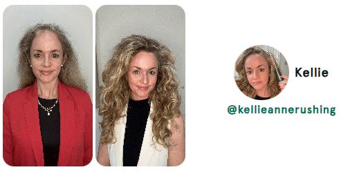 hair loss hair loss reversal natural hair loss reversal receding hair line hair growth natural hair growth hair growth remedy hair loss treatment nutrafol for women hair growth serum nutrafol for men alopecia areata alopecia hair regrowth for men rogaine for women rogaine for men best hair loss treatment hair growth shampoo keeps hair loss hims hair shampoo for hair loss beard growth dht blocker hair loss in women hair regrowth hair loss treatment for men hair doctor near me hair restoration near me hair regrowth for women best hair growth serum beard roller best shampoo for hair loss viviscal pro hair loss treatment for women hair specialist near me hair fall treatment hims hair growth best hair regrowth for men hair growth treatment thinning hair women best shampoo for hair growth vegamour hair serum hims hair loss nutrafol hair growth trichologist near me viviscal hair growth allurium hair growth serum thinning hair vegamour gro hair serum keranique hair regrowth treatment best hair loss treatment for female receding hairline postpartum hair loss hair growth for men hair clinic near me nutrafol hair hair implants for women bondi boost shampoo roman hair loss best hair regrowth for women hair regrowth treatment hair thinning treatment best hair loss treatment for male hair treatment for hair loss regrow hair naturally in 3 weeks best shampoo for hair loss female hair growth for women trichologist hair growth serum for women for hims hair capillus laser cap receding hairline treatment keeps hair treatment dermatologist recommended shampoo for hair loss hair loss prevention hair specialist doctor near me nutrafol women's balance hair transplant for women hair specialist nourishvita hair best shampoo for hair fall bondi boost hair growth female hair loss treatment mens hair loss hair falling out dermatologist hair loss specialist near me hair loss specialist near me best hair loss treatment for men hairfall solution hairmax laserband best hair serum for hair growth thinning hair men hair replacement for women moerie hair growth female hair loss hair fall control telogen effluvium best hair loss treatment for women hair loss doctor near me best hair growth male pattern baldness hair loss shampoo for men best hair regrowth treatment keeps hair loss treatment viviscal for women hair regrowth shampoo keranique hair regrowth hair loss clinic near me hair restoration for men keeps hair growth hair serum for hair growth hair loss cure hair loss serum laser cap for hair growth hair loss treatment near me male hair loss treatment kiierr laser cap hims hair regrowth treatment viviscal hair hair regrowth serum natural hair growth products hair loss clinic stop hair loss moerie hair shampoo for hair loss women viviscal shampoo hair loss doctor grow gorgeous hair growth serum hair growth treatment for women nutrafol for hair growth male pattern baldness treatment dermatologist for hair loss near me receding hairline men beard growth serum nutrafol hair growth serum hair growth treatment for men itchy scalp and hair loss vegamour hair growth serum hair treatment for men hair restoration for women dht blocker for women folexin hers hair growth keranique hair regrowth treatment for women hers hair regrowth treatment him hair loss best serum for hair growth and thickness bosley hair loss best hair growth for men best hair growth for women spectral dnc grow hair fast hair thinning treatment female laser hair growth hair growth serum for men neofollics shampoo hair plugs for women best treatment for thinning hair female best hair growth serum for women hair growth shampoo for men nutrafol hair growth supplement scalpmed for women spectral dnc n balding treatment nutrafol growth activator revivogen hims finasteride revivagen nutrifol for hims forhims topical finasteride finasteride 1mg finasteride for hair loss hims and hers buy finasteride finasteride tablets finasteride prescription hims finasteride finasteride 5mg 4hims oral finasteride finasteride online keeps finasteride finasteride pills buy finasteride online roman finasteride order finasteride hims sign in hims topical finasteride keeps topical finasteride cheapest finasteride propecia online finasteride for sale get finasteride prescription online finasteride cost finasteride for women order hims online order finasteride online finasteride hims hims products topical finasteride buy finasteride propecia generic finasteride finasteride hair growth finasteride over the counter finasteride online pharmacy best topical finasteride hims website bosley finasteride finasteride 1mg tablets buy propecia goodrx finasteride finasteride price happy head topical finasteride finasteride amazon hims hers buy topical finasteride finasteride keeps order propecia online get finasteride prescription hims finasteride cost get finasteride nutrifol men revivogen shampoo finasteride without prescription finasteride pills for hair loss finasteride 1mg amazon hims & hers cheapest finasteride online gethims finasteride hair cheapest way to get finasteride just for hims hims and hers health finasteride for men buy finasteride 1mg nutrifol for men finasteride hair regrowth get finasteride online xyon topical finasteride finasteride no prescription nutrifol for women order propecia finasteride 1mg price hims finasteride price finasteride goodrx hims for her buy finasteride 5mg topical finasteride amazon finasteride near me for hims sign in buy finasteride amazon finasteride cvs topical finasteride prescription topical fin for hims finasteride hims online cheapest topical finasteride buy finasteride for hair loss finasteride purchase finasteride roman numan finasteride 5mg finasteride best finasteride for hair loss roman topical finasteride hers and hims finasteride pharmacy best finasteride hims promo topical finasteride only finasteride for women's hair loss him finasteride finasteride 1mg online hims thick fix topical finasteride cost happy head finasteride topical finasteride for sale nutrifol women topical finasteride keeps hims official website hims and hers website hims men roman finasteride cost lemonaid finasteride for hims products oral finasteride for hair loss finasteride rx hims treatment www forhims hers hims finasteride walgreens finasteride medication finasteride receding hairline nutrifol reviews liposomal finasteride propecia finasteride 1mg hims health finasteride 5mg tablets topical finasteride for hair loss finasteride for sale online propecia prescription online hair loss tablets finasteride nutrifol shampoo hims amazon hims usa topical finasteride for women hair loss treatment finasteride finasteride for hair loss in female hims for women finasteride without doctor finasteride hairline topical finasteride online for hims topical finasteride topical finasteride hims finasteride for receding hairline buy finasteride tablets finasteride 0.5 mg finasteride how to get topical finasteride buy online finasteride prescription cost hims for hair forhims finasteride hims near me finasteride topical for hair loss finasteride cost per month finasteride hair treatment hims target sons finasteride finasteride and dutasteride finasteride reddit finasteride treatment finasteride for hair loss female finasteride 1mg prescription rogaine and finasteride liposomal topical finasteride finasteride 1mg for hair loss finasteride products finasteride 5mg price accord finasteride hims store finasteride discount propecia over the counter hims for sale cheapest finasteride 1mg hims healthcare revivogen md forhi cvs finasteride finasteride uses finasteride 6 months pharmica finasteride hims topical finasteride cost propecia hair growth blink health finasteride propecia buy online propecia price hims & hers health topical finasteride price male pattern baldness female pattern baldness alopecia hair loss treatment alopecia areata hair loss best hair loss treatment hair loss in women hair loss treatment for men hair loss treatment for women hair fall treatment hims hair loss best hair loss treatment for female best hair loss treatment for male hair treatment for hair loss hair loss prevention female hair loss treatment mens hair loss hair falling out hair loss specialist near me best hair loss treatment for men female hair loss hair fall control best hair loss treatment for women hair loss doctor near me hair loss clinic near me my hair is falling out hair loss cure hair loss treatment near me red light therapy for hair loss male hair loss treatment hair fall solution hair loss clinic stop hair loss hair loss doctor male pattern baldness treatment hair loss causes itchy scalp and hair loss him hair loss hair thinning treatment female balding treatment topical hair loss treatment hair fall hair loss after pregnancy hair loss prevention men hair loss specialist androgenic alopecia causes of hair loss in women alopecia areata causes hair fall doctor near me male hair loss hair loss solutions best hair treatment for hair loss olumiant for hair loss hair loss surgery hair thinning at front female alopecia areata self care hair loss solutions for men hair loss remedies best hair loss treatment for female home remedy reverse hair loss anti hair loss reasons for hair loss in women hair fall treatment near me bald spot on head bald spot treatment scalp treatment for hair loss hair thinning treatment male nioxin hair loss new hair loss treatment natural remedies for hair loss light therapy for hair loss olaplex hair loss my hair is thinning female male baldness treatment most effective hair loss treatment for hims hair loss hair fall treatment for women reasons for hair loss female pattern hair loss natural hair loss treatment pcos hair loss hair fall reasons in female best hair fall treatment keep hair loss female hair loss specialist near me hair loss help olumiant hair loss hair balding treatment best for hair loss stop hair loss women dermaroller for hair loss sudden hair loss in women dht hair loss stop hair loss men best thing for hair loss hair loss solutions for women hair transplant hair transplant cost hair transplant near me hair restoration hair restoration near me fue hair transplant hair implants hair replacement for men hair clinic near me hair implants for women hair plugs smile hair clinic hair implants for men cost beard transplant turkish hair transplant advanced hair restoration cost dhi hair transplant bosley hair transplant cost hair implants for men eyebrow transplant hair transplant for women hair replacement hair clinic hairline transplant hairline surgery fue hair transplant cost hair surgery best hair transplant hair replacement for women hairline restoration hermest hair clinic hair plugs cost hair transplant surgery hair plugs for men hair restoration for men hair implants near me hair transplant price hair restoration surgery hair replacement near me eyebrow hair transplant hair transplant consultation beard transplant cost mens hair transplant hair restoration for women fue hair transplant near me best hair transplant in the world bosley hair restoration cost hair plugs for women neograft hair transplant hair plantation cost non surgical hair replacement hairline transplant cost beard implants best hair restoration best hair doctor near me turkish hair transplant cost fut hair transplant stem cell hair transplant hair transplant clinic near me female hair transplant restore hair cost hairline lowering surgery hair follicle transplant cheap hair transplant hair plantation bosley hair replacement beard transplant near me hair implant cost hair restoration cost hair transplant clinic hair loss surgery 5000 grafts hair transplant cost eyebrow transplant near me hair surgery near me best hair transplant near me non surgical hair replacement near me eyebrow implants best place for hair transplant hair replacement surgery affordable hair transplant hair replacement for men near me beard hair transplant robotic hair transplant hair graft eyebrow transplant cost hair plantation near me neograft facial hair transplant hair implants for men near me average cost of hair transplant eyebrow grafting hair transplant procedure sule hair transplant cheap hair transplant near me female hair transplant cost hair transplant after 10 years hair growth surgery hair transplant without shaving best hair clinic near me hair plugs near me dr cinik hair transplant male hair transplant rob holding hair transplant bosley hair restoration & transplant bosley hair clinic fue hair asli tarcan hair clinic crown hair transplant bosley cost hair plant sule hair hair transplant doctors near me hairline restoration cost fue near me best hair restoration near me men's hair restoration near me hermest hair transplant stem cell hair restoration men's hair replacement near me fue cost hair transplant cost near me mens hair transplant near me dhi hair transplant cost advanced hair cost bosley hair cost facial hair implants best place to get hair transplant now hairtime hair restoration treatment bosley hair treatment cost serkan aygin clinic laser hair restoration eyebrow restoration natural transplants hair restoration clinic hairtransplant turkey hair transplant hairline 2000 grafts hair transplant cost best hair replacement hair grafting near me best turkish hair transplant medical hair centre yaker hair restoration hair loss clinics near me afro hair transplant fue transplant cost women's hair transplant cost cinik hair transplant tj hair clinic best hair transplant clinic in the world beard surgery hair transplant for receding hairline hair replacement cost surgical hair restoration male hair transplant cost hair graft cost rara hair transplant keeps hair restoration vera clinic hair transplant cost hair loss clinics beard implants near me robotic hair restoration black hair transplant artificial hair transplant fue transplant near me synthetic hair transplant hair transplant for black males fut hair transplant cost hair transplant options sapphire fue hair transplant dr brett bolton hair loss restoration robotic hair transplant cost dr leonard hair medaway hair transplant non surgical hair restoration hair restoration clinic direct hair implantation african american hair transplant eyebrow implants near me best hair transplant clinic vera clinic hair transplant restore hair transplant neograft hair transplant near me hair replacement for men cost hair implant surgery hair follicle surgery eyebrow hair transplant near me non surgical hair transplant follicular unit transplantation varona hair restoration biofibre hair transplant mens hair transplant cost sapphire hair clinic eyebrow hair transplant cost neograft hair transplant cost beard implants price natural hair transplant