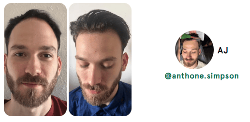 hair loss hair loss reversal natural hair loss reversal receding hair line hair growth natural hair growth hair growth remedy hair loss treatment nutrafol for women hair growth serum nutrafol for men alopecia areata alopecia hair regrowth for men rogaine for women rogaine for men best hair loss treatment hair growth shampoo keeps hair loss hims hair shampoo for hair loss beard growth dht blocker hair loss in women hair regrowth hair loss treatment for men hair doctor near me hair restoration near me hair regrowth for women best hair growth serum beard roller best shampoo for hair loss viviscal pro hair loss treatment for women hair specialist near me hair fall treatment hims hair growth best hair regrowth for men hair growth treatment thinning hair women best shampoo for hair growth vegamour hair serum hims hair loss nutrafol hair growth trichologist near me viviscal hair growth allurium hair growth serum thinning hair vegamour gro hair serum keranique hair regrowth treatment best hair loss treatment for female receding hairline postpartum hair loss hair growth for men hair clinic near me nutrafol hair hair implants for women bondi boost shampoo roman hair loss best hair regrowth for women hair regrowth treatment hair thinning treatment best hair loss treatment for male hair treatment for hair loss regrow hair naturally in 3 weeks best shampoo for hair loss female hair growth for women trichologist hair growth serum for women for hims hair capillus laser cap receding hairline treatment keeps hair treatment dermatologist recommended shampoo for hair loss hair loss prevention hair specialist doctor near me nutrafol women's balance hair transplant for women hair specialist nourishvita hair best shampoo for hair fall bondi boost hair growth female hair loss treatment mens hair loss hair falling out dermatologist hair loss specialist near me hair loss specialist near me best hair loss treatment for men hairfall solution hairmax laserband best hair serum for hair growth thinning hair men hair replacement for women moerie hair growth female hair loss hair fall control telogen effluvium best hair loss treatment for women hair loss doctor near me best hair growth male pattern baldness hair loss shampoo for men best hair regrowth treatment keeps hair loss treatment viviscal for women hair regrowth shampoo keranique hair regrowth hair loss clinic near me hair restoration for men keeps hair growth hair serum for hair growth hair loss cure hair loss serum laser cap for hair growth hair loss treatment near me male hair loss treatment kiierr laser cap hims hair regrowth treatment viviscal hair hair regrowth serum natural hair growth products hair loss clinic stop hair loss moerie hair shampoo for hair loss women viviscal shampoo hair loss doctor grow gorgeous hair growth serum hair growth treatment for women nutrafol for hair growth male pattern baldness treatment dermatologist for hair loss near me receding hairline men beard growth serum nutrafol hair growth serum hair growth treatment for men itchy scalp and hair loss vegamour hair growth serum hair treatment for men hair restoration for women dht blocker for women folexin hers hair growth keranique hair regrowth treatment for women hers hair regrowth treatment him hair loss best serum for hair growth and thickness bosley hair loss best hair growth for men best hair growth for women spectral dnc grow hair fast hair thinning treatment female laser hair growth hair growth serum for men neofollics shampoo hair plugs for women best treatment for thinning hair female best hair growth serum for women hair growth shampoo for men nutrafol hair growth supplement scalpmed for women spectral dnc n balding treatment nutrafol growth activator revivogen hims finasteride revivagen nutrifol for hims forhims topical finasteride finasteride 1mg finasteride for hair loss hims and hers buy finasteride finasteride tablets finasteride prescription hims finasteride finasteride 5mg 4hims oral finasteride finasteride online keeps finasteride finasteride pills buy finasteride online roman finasteride order finasteride hims sign in hims topical finasteride keeps topical finasteride cheapest finasteride propecia online finasteride for sale get finasteride prescription online finasteride cost finasteride for women order hims online order finasteride online finasteride hims hims products topical finasteride buy finasteride propecia generic finasteride finasteride hair growth finasteride over the counter finasteride online pharmacy best topical finasteride hims website bosley finasteride finasteride 1mg tablets buy propecia goodrx finasteride finasteride price happy head topical finasteride finasteride amazon hims hers buy topical finasteride finasteride keeps order propecia online get finasteride prescription hims finasteride cost get finasteride nutrifol men revivogen shampoo finasteride without prescription finasteride pills for hair loss finasteride 1mg amazon hims & hers cheapest finasteride online gethims finasteride hair cheapest way to get finasteride just for hims hims and hers health finasteride for men buy finasteride 1mg nutrifol for men finasteride hair regrowth get finasteride online xyon topical finasteride finasteride no prescription nutrifol for women order propecia finasteride 1mg price hims finasteride price finasteride goodrx hims for her buy finasteride 5mg topical finasteride amazon finasteride near me for hims sign in buy finasteride amazon finasteride cvs topical finasteride prescription topical fin for hims finasteride hims online cheapest topical finasteride buy finasteride for hair loss finasteride purchase finasteride roman numan finasteride 5mg finasteride best finasteride for hair loss roman topical finasteride hers and hims finasteride pharmacy best finasteride hims promo topical finasteride only finasteride for women's hair loss him finasteride finasteride 1mg online hims thick fix topical finasteride cost happy head finasteride topical finasteride for sale nutrifol women topical finasteride keeps hims official website hims and hers website hims men roman finasteride cost lemonaid finasteride for hims products oral finasteride for hair loss finasteride rx hims treatment www forhims hers hims finasteride walgreens finasteride medication finasteride receding hairline nutrifol reviews liposomal finasteride propecia finasteride 1mg hims health finasteride 5mg tablets topical finasteride for hair loss finasteride for sale online propecia prescription online hair loss tablets finasteride nutrifol shampoo hims amazon hims usa topical finasteride for women hair loss treatment finasteride finasteride for hair loss in female hims for women finasteride without doctor finasteride hairline topical finasteride online for hims topical finasteride topical finasteride hims finasteride for receding hairline buy finasteride tablets finasteride 0.5 mg finasteride how to get topical finasteride buy online finasteride prescription cost hims for hair forhims finasteride hims near me finasteride topical for hair loss finasteride cost per month finasteride hair treatment hims target sons finasteride finasteride and dutasteride finasteride reddit finasteride treatment finasteride for hair loss female finasteride 1mg prescription rogaine and finasteride liposomal topical finasteride finasteride 1mg for hair loss finasteride products finasteride 5mg price accord finasteride hims store finasteride discount propecia over the counter hims for sale cheapest finasteride 1mg hims healthcare revivogen md forhi cvs finasteride finasteride uses finasteride 6 months pharmica finasteride hims topical finasteride cost propecia hair growth blink health finasteride propecia buy online propecia price hims & hers health topical finasteride price male pattern baldness female pattern baldness alopecia hair loss treatment alopecia areata hair loss best hair loss treatment hair loss in women hair loss treatment for men hair loss treatment for women hair fall treatment hims hair loss best hair loss treatment for female best hair loss treatment for male hair treatment for hair loss hair loss prevention female hair loss treatment mens hair loss hair falling out hair loss specialist near me best hair loss treatment for men female hair loss hair fall control best hair loss treatment for women hair loss doctor near me hair loss clinic near me my hair is falling out hair loss cure hair loss treatment near me red light therapy for hair loss male hair loss treatment hair fall solution hair loss clinic stop hair loss hair loss doctor male pattern baldness treatment hair loss causes itchy scalp and hair loss him hair loss hair thinning treatment female balding treatment topical hair loss treatment hair fall hair loss after pregnancy hair loss prevention men hair loss specialist androgenic alopecia causes of hair loss in women alopecia areata causes hair fall doctor near me male hair loss hair loss solutions best hair treatment for hair loss olumiant for hair loss hair loss surgery hair thinning at front female alopecia areata self care hair loss solutions for men hair loss remedies best hair loss treatment for female home remedy reverse hair loss anti hair loss reasons for hair loss in women hair fall treatment near me bald spot on head bald spot treatment scalp treatment for hair loss hair thinning treatment male nioxin hair loss new hair loss treatment natural remedies for hair loss light therapy for hair loss olaplex hair loss my hair is thinning female male baldness treatment most effective hair loss treatment for hims hair loss hair fall treatment for women reasons for hair loss female pattern hair loss natural hair loss treatment pcos hair loss hair fall reasons in female best hair fall treatment keep hair loss female hair loss specialist near me hair loss help olumiant hair loss hair balding treatment best for hair loss stop hair loss women dermaroller for hair loss sudden hair loss in women dht hair loss stop hair loss men best thing for hair loss hair loss solutions for women hair transplant hair transplant cost hair transplant near me hair restoration hair restoration near me fue hair transplant hair implants hair replacement for men hair clinic near me hair implants for women hair plugs smile hair clinic hair implants for men cost beard transplant turkish hair transplant advanced hair restoration cost dhi hair transplant bosley hair transplant cost hair implants for men eyebrow transplant hair transplant for women hair replacement hair clinic hairline transplant hairline surgery fue hair transplant cost hair surgery best hair transplant hair replacement for women hairline restoration hermest hair clinic hair plugs cost hair transplant surgery hair plugs for men hair restoration for men hair implants near me hair transplant price hair restoration surgery hair replacement near me eyebrow hair transplant hair transplant consultation beard transplant cost mens hair transplant hair restoration for women fue hair transplant near me best hair transplant in the world bosley hair restoration cost hair plugs for women neograft hair transplant hair plantation cost non surgical hair replacement hairline transplant cost beard implants best hair restoration best hair doctor near me turkish hair transplant cost fut hair transplant stem cell hair transplant hair transplant clinic near me female hair transplant restore hair cost hairline lowering surgery hair follicle transplant cheap hair transplant hair plantation bosley hair replacement beard transplant near me hair implant cost hair restoration cost hair transplant clinic hair loss surgery 5000 grafts hair transplant cost eyebrow transplant near me hair surgery near me best hair transplant near me non surgical hair replacement near me eyebrow implants best place for hair transplant hair replacement surgery affordable hair transplant hair replacement for men near me beard hair transplant robotic hair transplant hair graft eyebrow transplant cost hair plantation near me neograft facial hair transplant hair implants for men near me average cost of hair transplant eyebrow grafting hair transplant procedure sule hair transplant cheap hair transplant near me female hair transplant cost hair transplant after 10 years hair growth surgery hair transplant without shaving best hair clinic near me hair plugs near me dr cinik hair transplant male hair transplant rob holding hair transplant bosley hair restoration & transplant bosley hair clinic fue hair asli tarcan hair clinic crown hair transplant bosley cost hair plant sule hair hair transplant doctors near me hairline restoration cost fue near me best hair restoration near me men's hair restoration near me hermest hair transplant stem cell hair restoration men's hair replacement near me fue cost hair transplant cost near me mens hair transplant near me dhi hair transplant cost advanced hair cost bosley hair cost facial hair implants best place to get hair transplant now hairtime hair restoration treatment bosley hair treatment cost serkan aygin clinic laser hair restoration eyebrow restoration natural transplants hair restoration clinic hairtransplant turkey hair transplant hairline 2000 grafts hair transplant cost best hair replacement hair grafting near me best turkish hair transplant medical hair centre yaker hair restoration hair loss clinics near me afro hair transplant fue transplant cost women's hair transplant cost cinik hair transplant tj hair clinic best hair transplant clinic in the world beard surgery hair transplant for receding hairline hair replacement cost surgical hair restoration male hair transplant cost hair graft cost rara hair transplant keeps hair restoration vera clinic hair transplant cost hair loss clinics beard implants near me robotic hair restoration black hair transplant artificial hair transplant fue transplant near me synthetic hair transplant hair transplant for black males fut hair transplant cost hair transplant options sapphire fue hair transplant dr brett bolton hair loss restoration robotic hair transplant cost dr leonard hair medaway hair transplant non surgical hair restoration hair restoration clinic direct hair implantation african american hair transplant eyebrow implants near me best hair transplant clinic vera clinic hair transplant restore hair transplant neograft hair transplant near me hair replacement for men cost hair implant surgery hair follicle surgery eyebrow hair transplant near me non surgical hair transplant follicular unit transplantation varona hair restoration biofibre hair transplant mens hair transplant cost sapphire hair clinic eyebrow hair transplant cost neograft hair transplant cost beard implants price natural hair transplant