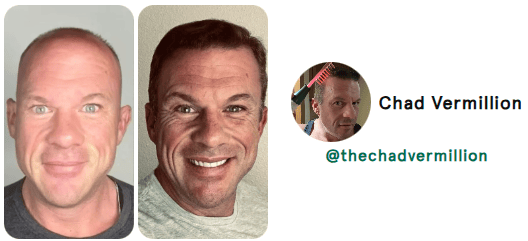 hair loss hair loss reversal natural hair loss reversal receding hair line hair growth natural hair growth hair growth remedy hair loss treatment nutrafol for women hair growth serum nutrafol for men alopecia areata alopecia hair regrowth for men rogaine for women rogaine for men best hair loss treatment hair growth shampoo keeps hair loss hims hair shampoo for hair loss beard growth dht blocker hair loss in women hair regrowth hair loss treatment for men hair doctor near me hair restoration near me hair regrowth for women best hair growth serum beard roller best shampoo for hair loss viviscal pro hair loss treatment for women hair specialist near me hair fall treatment hims hair growth best hair regrowth for men hair growth treatment thinning hair women best shampoo for hair growth vegamour hair serum hims hair loss nutrafol hair growth trichologist near me viviscal hair growth allurium hair growth serum thinning hair vegamour gro hair serum keranique hair regrowth treatment best hair loss treatment for female receding hairline postpartum hair loss hair growth for men hair clinic near me nutrafol hair hair implants for women bondi boost shampoo roman hair loss best hair regrowth for women hair regrowth treatment hair thinning treatment best hair loss treatment for male hair treatment for hair loss regrow hair naturally in 3 weeks best shampoo for hair loss female hair growth for women trichologist hair growth serum for women for hims hair capillus laser cap receding hairline treatment keeps hair treatment dermatologist recommended shampoo for hair loss hair loss prevention hair specialist doctor near me nutrafol women's balance hair transplant for women hair specialist nourishvita hair best shampoo for hair fall bondi boost hair growth female hair loss treatment mens hair loss hair falling out dermatologist hair loss specialist near me hair loss specialist near me best hair loss treatment for men hairfall solution hairmax laserband best hair serum for hair growth thinning hair men hair replacement for women moerie hair growth female hair loss hair fall control telogen effluvium best hair loss treatment for women hair loss doctor near me best hair growth male pattern baldness hair loss shampoo for men best hair regrowth treatment keeps hair loss treatment viviscal for women hair regrowth shampoo keranique hair regrowth hair loss clinic near me hair restoration for men keeps hair growth hair serum for hair growth hair loss cure hair loss serum laser cap for hair growth hair loss treatment near me male hair loss treatment kiierr laser cap hims hair regrowth treatment viviscal hair hair regrowth serum natural hair growth products hair loss clinic stop hair loss moerie hair shampoo for hair loss women viviscal shampoo hair loss doctor grow gorgeous hair growth serum hair growth treatment for women nutrafol for hair growth male pattern baldness treatment dermatologist for hair loss near me receding hairline men beard growth serum nutrafol hair growth serum hair growth treatment for men itchy scalp and hair loss vegamour hair growth serum hair treatment for men hair restoration for women dht blocker for women folexin hers hair growth keranique hair regrowth treatment for women hers hair regrowth treatment him hair loss best serum for hair growth and thickness bosley hair loss best hair growth for men best hair growth for women spectral dnc grow hair fast hair thinning treatment female laser hair growth hair growth serum for men neofollics shampoo hair plugs for women best treatment for thinning hair female best hair growth serum for women hair growth shampoo for men nutrafol hair growth supplement scalpmed for women spectral dnc n balding treatment nutrafol growth activator revivogen hims finasteride revivagen nutrifol for hims forhims topical finasteride finasteride 1mg finasteride for hair loss hims and hers buy finasteride finasteride tablets finasteride prescription hims finasteride finasteride 5mg 4hims oral finasteride finasteride online keeps finasteride finasteride pills buy finasteride online roman finasteride order finasteride hims sign in hims topical finasteride keeps topical finasteride cheapest finasteride propecia online finasteride for sale get finasteride prescription online finasteride cost finasteride for women order hims online order finasteride online finasteride hims hims products topical finasteride buy finasteride propecia generic finasteride finasteride hair growth finasteride over the counter finasteride online pharmacy best topical finasteride hims website bosley finasteride finasteride 1mg tablets buy propecia goodrx finasteride finasteride price happy head topical finasteride finasteride amazon hims hers buy topical finasteride finasteride keeps order propecia online get finasteride prescription hims finasteride cost get finasteride nutrifol men revivogen shampoo finasteride without prescription finasteride pills for hair loss finasteride 1mg amazon hims & hers cheapest finasteride online gethims finasteride hair cheapest way to get finasteride just for hims hims and hers health finasteride for men buy finasteride 1mg nutrifol for men finasteride hair regrowth get finasteride online xyon topical finasteride finasteride no prescription nutrifol for women order propecia finasteride 1mg price hims finasteride price finasteride goodrx hims for her buy finasteride 5mg topical finasteride amazon finasteride near me for hims sign in buy finasteride amazon finasteride cvs topical finasteride prescription topical fin for hims finasteride hims online cheapest topical finasteride buy finasteride for hair loss finasteride purchase finasteride roman numan finasteride 5mg finasteride best finasteride for hair loss roman topical finasteride hers and hims finasteride pharmacy best finasteride hims promo topical finasteride only finasteride for women's hair loss him finasteride finasteride 1mg online hims thick fix topical finasteride cost happy head finasteride topical finasteride for sale nutrifol women topical finasteride keeps hims official website hims and hers website hims men roman finasteride cost lemonaid finasteride for hims products oral finasteride for hair loss finasteride rx hims treatment www forhims hers hims finasteride walgreens finasteride medication finasteride receding hairline nutrifol reviews liposomal finasteride propecia finasteride 1mg hims health finasteride 5mg tablets topical finasteride for hair loss finasteride for sale online propecia prescription online hair loss tablets finasteride nutrifol shampoo hims amazon hims usa topical finasteride for women hair loss treatment finasteride finasteride for hair loss in female hims for women finasteride without doctor finasteride hairline topical finasteride online for hims topical finasteride topical finasteride hims finasteride for receding hairline buy finasteride tablets finasteride 0.5 mg finasteride how to get topical finasteride buy online finasteride prescription cost hims for hair forhims finasteride hims near me finasteride topical for hair loss finasteride cost per month finasteride hair treatment hims target sons finasteride finasteride and dutasteride finasteride reddit finasteride treatment finasteride for hair loss female finasteride 1mg prescription rogaine and finasteride liposomal topical finasteride finasteride 1mg for hair loss finasteride products finasteride 5mg price accord finasteride hims store finasteride discount propecia over the counter hims for sale cheapest finasteride 1mg hims healthcare revivogen md forhi cvs finasteride finasteride uses finasteride 6 months pharmica finasteride hims topical finasteride cost propecia hair growth blink health finasteride propecia buy online propecia price hims & hers health topical finasteride price male pattern baldness female pattern baldness alopecia hair loss treatment alopecia areata hair loss best hair loss treatment hair loss in women hair loss treatment for men hair loss treatment for women hair fall treatment hims hair loss best hair loss treatment for female best hair loss treatment for male hair treatment for hair loss hair loss prevention female hair loss treatment mens hair loss hair falling out hair loss specialist near me best hair loss treatment for men female hair loss hair fall control best hair loss treatment for women hair loss doctor near me hair loss clinic near me my hair is falling out hair loss cure hair loss treatment near me red light therapy for hair loss male hair loss treatment hair fall solution hair loss clinic stop hair loss hair loss doctor male pattern baldness treatment hair loss causes itchy scalp and hair loss him hair loss hair thinning treatment female balding treatment topical hair loss treatment hair fall hair loss after pregnancy hair loss prevention men hair loss specialist androgenic alopecia causes of hair loss in women alopecia areata causes hair fall doctor near me male hair loss hair loss solutions best hair treatment for hair loss olumiant for hair loss hair loss surgery hair thinning at front female alopecia areata self care hair loss solutions for men hair loss remedies best hair loss treatment for female home remedy reverse hair loss anti hair loss reasons for hair loss in women hair fall treatment near me bald spot on head bald spot treatment scalp treatment for hair loss hair thinning treatment male nioxin hair loss new hair loss treatment natural remedies for hair loss light therapy for hair loss olaplex hair loss my hair is thinning female male baldness treatment most effective hair loss treatment for hims hair loss hair fall treatment for women reasons for hair loss female pattern hair loss natural hair loss treatment pcos hair loss hair fall reasons in female best hair fall treatment keep hair loss female hair loss specialist near me hair loss help olumiant hair loss hair balding treatment best for hair loss stop hair loss women dermaroller for hair loss sudden hair loss in women dht hair loss stop hair loss men best thing for hair loss hair loss solutions for women hair transplant hair transplant cost hair transplant near me hair restoration hair restoration near me fue hair transplant hair implants hair replacement for men hair clinic near me hair implants for women hair plugs smile hair clinic hair implants for men cost beard transplant turkish hair transplant advanced hair restoration cost dhi hair transplant bosley hair transplant cost hair implants for men eyebrow transplant hair transplant for women hair replacement hair clinic hairline transplant hairline surgery fue hair transplant cost hair surgery best hair transplant hair replacement for women hairline restoration hermest hair clinic hair plugs cost hair transplant surgery hair plugs for men hair restoration for men hair implants near me hair transplant price hair restoration surgery hair replacement near me eyebrow hair transplant hair transplant consultation beard transplant cost mens hair transplant hair restoration for women fue hair transplant near me best hair transplant in the world bosley hair restoration cost hair plugs for women neograft hair transplant hair plantation cost non surgical hair replacement hairline transplant cost beard implants best hair restoration best hair doctor near me turkish hair transplant cost fut hair transplant stem cell hair transplant hair transplant clinic near me female hair transplant restore hair cost hairline lowering surgery hair follicle transplant cheap hair transplant hair plantation bosley hair replacement beard transplant near me hair implant cost hair restoration cost hair transplant clinic hair loss surgery 5000 grafts hair transplant cost eyebrow transplant near me hair surgery near me best hair transplant near me non surgical hair replacement near me eyebrow implants best place for hair transplant hair replacement surgery affordable hair transplant hair replacement for men near me beard hair transplant robotic hair transplant hair graft eyebrow transplant cost hair plantation near me neograft facial hair transplant hair implants for men near me average cost of hair transplant eyebrow grafting hair transplant procedure sule hair transplant cheap hair transplant near me female hair transplant cost hair transplant after 10 years hair growth surgery hair transplant without shaving best hair clinic near me hair plugs near me dr cinik hair transplant male hair transplant rob holding hair transplant bosley hair restoration & transplant bosley hair clinic fue hair asli tarcan hair clinic crown hair transplant bosley cost hair plant sule hair hair transplant doctors near me hairline restoration cost fue near me best hair restoration near me men's hair restoration near me hermest hair transplant stem cell hair restoration men's hair replacement near me fue cost hair transplant cost near me mens hair transplant near me dhi hair transplant cost advanced hair cost bosley hair cost facial hair implants best place to get hair transplant now hairtime hair restoration treatment bosley hair treatment cost serkan aygin clinic laser hair restoration eyebrow restoration natural transplants hair restoration clinic hairtransplant turkey hair transplant hairline 2000 grafts hair transplant cost best hair replacement hair grafting near me best turkish hair transplant medical hair centre yaker hair restoration hair loss clinics near me afro hair transplant fue transplant cost women's hair transplant cost cinik hair transplant tj hair clinic best hair transplant clinic in the world beard surgery hair transplant for receding hairline hair replacement cost surgical hair restoration male hair transplant cost hair graft cost rara hair transplant keeps hair restoration vera clinic hair transplant cost hair loss clinics beard implants near me robotic hair restoration black hair transplant artificial hair transplant fue transplant near me synthetic hair transplant hair transplant for black males fut hair transplant cost hair transplant options sapphire fue hair transplant dr brett bolton hair loss restoration robotic hair transplant cost dr leonard hair medaway hair transplant non surgical hair restoration hair restoration clinic direct hair implantation african american hair transplant eyebrow implants near me best hair transplant clinic vera clinic hair transplant restore hair transplant neograft hair transplant near me hair replacement for men cost hair implant surgery hair follicle surgery eyebrow hair transplant near me non surgical hair transplant follicular unit transplantation varona hair restoration biofibre hair transplant mens hair transplant cost sapphire hair clinic eyebrow hair transplant cost neograft hair transplant cost beard implants price natural hair transplant