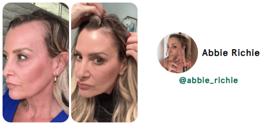 hair loss hair loss reversal natural hair loss reversal receding hair line hair growth natural hair growth hair growth remedy hair loss treatment nutrafol for women hair growth serum nutrafol for men alopecia areata alopecia hair regrowth for men rogaine for women rogaine for men best hair loss treatment hair growth shampoo keeps hair loss hims hair shampoo for hair loss beard growth dht blocker hair loss in women hair regrowth hair loss treatment for men hair doctor near me hair restoration near me hair regrowth for women best hair growth serum beard roller best shampoo for hair loss viviscal pro hair loss treatment for women hair specialist near me hair fall treatment hims hair growth best hair regrowth for men hair growth treatment thinning hair women best shampoo for hair growth vegamour hair serum hims hair loss nutrafol hair growth trichologist near me viviscal hair growth allurium hair growth serum thinning hair vegamour gro hair serum keranique hair regrowth treatment best hair loss treatment for female receding hairline postpartum hair loss hair growth for men hair clinic near me nutrafol hair hair implants for women bondi boost shampoo roman hair loss best hair regrowth for women hair regrowth treatment hair thinning treatment best hair loss treatment for male hair treatment for hair loss regrow hair naturally in 3 weeks best shampoo for hair loss female hair growth for women trichologist hair growth serum for women for hims hair capillus laser cap receding hairline treatment keeps hair treatment dermatologist recommended shampoo for hair loss hair loss prevention hair specialist doctor near me nutrafol women's balance hair transplant for women hair specialist nourishvita hair best shampoo for hair fall bondi boost hair growth female hair loss treatment mens hair loss hair falling out dermatologist hair loss specialist near me hair loss specialist near me best hair loss treatment for men hairfall solution hairmax laserband best hair serum for hair growth thinning hair men hair replacement for women moerie hair growth female hair loss hair fall control telogen effluvium best hair loss treatment for women hair loss doctor near me best hair growth male pattern baldness hair loss shampoo for men best hair regrowth treatment keeps hair loss treatment viviscal for women hair regrowth shampoo keranique hair regrowth hair loss clinic near me hair restoration for men keeps hair growth hair serum for hair growth hair loss cure hair loss serum laser cap for hair growth hair loss treatment near me male hair loss treatment kiierr laser cap hims hair regrowth treatment viviscal hair hair regrowth serum natural hair growth products hair loss clinic stop hair loss moerie hair shampoo for hair loss women viviscal shampoo hair loss doctor grow gorgeous hair growth serum hair growth treatment for women nutrafol for hair growth male pattern baldness treatment dermatologist for hair loss near me receding hairline men beard growth serum nutrafol hair growth serum hair growth treatment for men itchy scalp and hair loss vegamour hair growth serum hair treatment for men hair restoration for women dht blocker for women folexin hers hair growth keranique hair regrowth treatment for women hers hair regrowth treatment him hair loss best serum for hair growth and thickness bosley hair loss best hair growth for men best hair growth for women spectral dnc grow hair fast hair thinning treatment female laser hair growth hair growth serum for men neofollics shampoo hair plugs for women best treatment for thinning hair female best hair growth serum for women hair growth shampoo for men nutrafol hair growth supplement scalpmed for women spectral dnc n balding treatment nutrafol growth activator revivogen hims finasteride revivagen nutrifol for hims forhims topical finasteride finasteride 1mg finasteride for hair loss hims and hers buy finasteride finasteride tablets finasteride prescription hims finasteride finasteride 5mg 4hims oral finasteride finasteride online keeps finasteride finasteride pills buy finasteride online roman finasteride order finasteride hims sign in hims topical finasteride keeps topical finasteride cheapest finasteride propecia online finasteride for sale get finasteride prescription online finasteride cost finasteride for women order hims online order finasteride online finasteride hims hims products topical finasteride buy finasteride propecia generic finasteride finasteride hair growth finasteride over the counter finasteride online pharmacy best topical finasteride hims website bosley finasteride finasteride 1mg tablets buy propecia goodrx finasteride finasteride price happy head topical finasteride finasteride amazon hims hers buy topical finasteride finasteride keeps order propecia online get finasteride prescription hims finasteride cost get finasteride nutrifol men revivogen shampoo finasteride without prescription finasteride pills for hair loss finasteride 1mg amazon hims & hers cheapest finasteride online gethims finasteride hair cheapest way to get finasteride just for hims hims and hers health finasteride for men buy finasteride 1mg nutrifol for men finasteride hair regrowth get finasteride online xyon topical finasteride finasteride no prescription nutrifol for women order propecia finasteride 1mg price hims finasteride price finasteride goodrx hims for her buy finasteride 5mg topical finasteride amazon finasteride near me for hims sign in buy finasteride amazon finasteride cvs topical finasteride prescription topical fin for hims finasteride hims online cheapest topical finasteride buy finasteride for hair loss finasteride purchase finasteride roman numan finasteride 5mg finasteride best finasteride for hair loss roman topical finasteride hers and hims finasteride pharmacy best finasteride hims promo topical finasteride only finasteride for women's hair loss him finasteride finasteride 1mg online hims thick fix topical finasteride cost happy head finasteride topical finasteride for sale nutrifol women topical finasteride keeps hims official website hims and hers website hims men roman finasteride cost lemonaid finasteride for hims products oral finasteride for hair loss finasteride rx hims treatment www forhims hers hims finasteride walgreens finasteride medication finasteride receding hairline nutrifol reviews liposomal finasteride propecia finasteride 1mg hims health finasteride 5mg tablets topical finasteride for hair loss finasteride for sale online propecia prescription online hair loss tablets finasteride nutrifol shampoo hims amazon hims usa topical finasteride for women hair loss treatment finasteride finasteride for hair loss in female hims for women finasteride without doctor finasteride hairline topical finasteride online for hims topical finasteride topical finasteride hims finasteride for receding hairline buy finasteride tablets finasteride 0.5 mg finasteride how to get topical finasteride buy online finasteride prescription cost hims for hair forhims finasteride hims near me finasteride topical for hair loss finasteride cost per month finasteride hair treatment hims target sons finasteride finasteride and dutasteride finasteride reddit finasteride treatment finasteride for hair loss female finasteride 1mg prescription rogaine and finasteride liposomal topical finasteride finasteride 1mg for hair loss finasteride products finasteride 5mg price accord finasteride hims store finasteride discount propecia over the counter hims for sale cheapest finasteride 1mg hims healthcare revivogen md forhi cvs finasteride finasteride uses finasteride 6 months pharmica finasteride hims topical finasteride cost propecia hair growth blink health finasteride propecia buy online propecia price hims & hers health topical finasteride price male pattern baldness female pattern baldness alopecia hair loss treatment alopecia areata hair loss best hair loss treatment hair loss in women hair loss treatment for men hair loss treatment for women hair fall treatment hims hair loss best hair loss treatment for female best hair loss treatment for male hair treatment for hair loss hair loss prevention female hair loss treatment mens hair loss hair falling out hair loss specialist near me best hair loss treatment for men female hair loss hair fall control best hair loss treatment for women hair loss doctor near me hair loss clinic near me my hair is falling out hair loss cure hair loss treatment near me red light therapy for hair loss male hair loss treatment hair fall solution hair loss clinic stop hair loss hair loss doctor male pattern baldness treatment hair loss causes itchy scalp and hair loss him hair loss hair thinning treatment female balding treatment topical hair loss treatment hair fall hair loss after pregnancy hair loss prevention men hair loss specialist androgenic alopecia causes of hair loss in women alopecia areata causes hair fall doctor near me male hair loss hair loss solutions best hair treatment for hair loss olumiant for hair loss hair loss surgery hair thinning at front female alopecia areata self care hair loss solutions for men hair loss remedies best hair loss treatment for female home remedy reverse hair loss anti hair loss reasons for hair loss in women hair fall treatment near me bald spot on head bald spot treatment scalp treatment for hair loss hair thinning treatment male nioxin hair loss new hair loss treatment natural remedies for hair loss light therapy for hair loss olaplex hair loss my hair is thinning female male baldness treatment most effective hair loss treatment for hims hair loss hair fall treatment for women reasons for hair loss female pattern hair loss natural hair loss treatment pcos hair loss hair fall reasons in female best hair fall treatment keep hair loss female hair loss specialist near me hair loss help olumiant hair loss hair balding treatment best for hair loss stop hair loss women dermaroller for hair loss sudden hair loss in women dht hair loss stop hair loss men best thing for hair loss hair loss solutions for women hair transplant hair transplant cost hair transplant near me hair restoration hair restoration near me fue hair transplant hair implants hair replacement for men hair clinic near me hair implants for women hair plugs smile hair clinic hair implants for men cost beard transplant turkish hair transplant advanced hair restoration cost dhi hair transplant bosley hair transplant cost hair implants for men eyebrow transplant hair transplant for women hair replacement hair clinic hairline transplant hairline surgery fue hair transplant cost hair surgery best hair transplant hair replacement for women hairline restoration hermest hair clinic hair plugs cost hair transplant surgery hair plugs for men hair restoration for men hair implants near me hair transplant price hair restoration surgery hair replacement near me eyebrow hair transplant hair transplant consultation beard transplant cost mens hair transplant hair restoration for women fue hair transplant near me best hair transplant in the world bosley hair restoration cost hair plugs for women neograft hair transplant hair plantation cost non surgical hair replacement hairline transplant cost beard implants best hair restoration best hair doctor near me turkish hair transplant cost fut hair transplant stem cell hair transplant hair transplant clinic near me female hair transplant restore hair cost hairline lowering surgery hair follicle transplant cheap hair transplant hair plantation bosley hair replacement beard transplant near me hair implant cost hair restoration cost hair transplant clinic hair loss surgery 5000 grafts hair transplant cost eyebrow transplant near me hair surgery near me best hair transplant near me non surgical hair replacement near me eyebrow implants best place for hair transplant hair replacement surgery affordable hair transplant hair replacement for men near me beard hair transplant robotic hair transplant hair graft eyebrow transplant cost hair plantation near me neograft facial hair transplant hair implants for men near me average cost of hair transplant eyebrow grafting hair transplant procedure sule hair transplant cheap hair transplant near me female hair transplant cost hair transplant after 10 years hair growth surgery hair transplant without shaving best hair clinic near me hair plugs near me dr cinik hair transplant male hair transplant rob holding hair transplant bosley hair restoration & transplant bosley hair clinic fue hair asli tarcan hair clinic crown hair transplant bosley cost hair plant sule hair hair transplant doctors near me hairline restoration cost fue near me best hair restoration near me men's hair restoration near me hermest hair transplant stem cell hair restoration men's hair replacement near me fue cost hair transplant cost near me mens hair transplant near me dhi hair transplant cost advanced hair cost bosley hair cost facial hair implants best place to get hair transplant now hairtime hair restoration treatment bosley hair treatment cost serkan aygin clinic laser hair restoration eyebrow restoration natural transplants hair restoration clinic hairtransplant turkey hair transplant hairline 2000 grafts hair transplant cost best hair replacement hair grafting near me best turkish hair transplant medical hair centre yaker hair restoration hair loss clinics near me afro hair transplant fue transplant cost women's hair transplant cost cinik hair transplant tj hair clinic best hair transplant clinic in the world beard surgery hair transplant for receding hairline hair replacement cost surgical hair restoration male hair transplant cost hair graft cost rara hair transplant keeps hair restoration vera clinic hair transplant cost hair loss clinics beard implants near me robotic hair restoration black hair transplant artificial hair transplant fue transplant near me synthetic hair transplant hair transplant for black males fut hair transplant cost hair transplant options sapphire fue hair transplant dr brett bolton hair loss restoration robotic hair transplant cost dr leonard hair medaway hair transplant non surgical hair restoration hair restoration clinic direct hair implantation african american hair transplant eyebrow implants near me best hair transplant clinic vera clinic hair transplant restore hair transplant neograft hair transplant near me hair replacement for men cost hair implant surgery hair follicle surgery eyebrow hair transplant near me non surgical hair transplant follicular unit transplantation varona hair restoration biofibre hair transplant mens hair transplant cost sapphire hair clinic eyebrow hair transplant cost neograft hair transplant cost beard implants price natural hair transplant